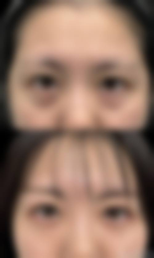 五、佛山幼肤医学美容价格表