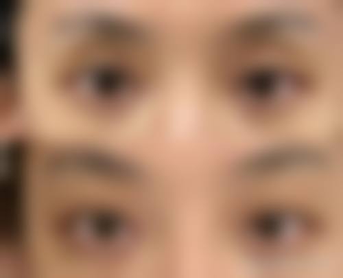 九、昆明三一一医院医学美容中 心真实的患者评价