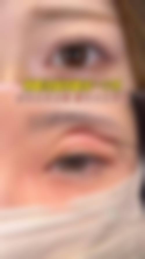 八、昆明医梵整形医院预约方式