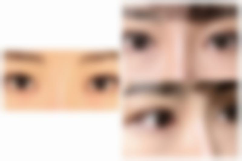 四、关注“红霉素眼膏可以祛眼袋吗”相关的用药注意事项