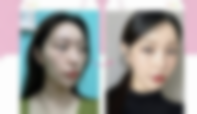 八、大同艾菲尔医疗美容门诊部预约方式