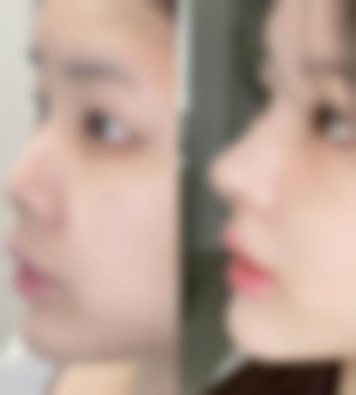 三、不同阶段治疗方案选择