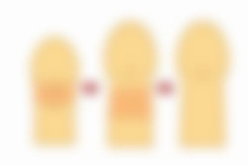 六、理性看待耳软骨隆鼻尖