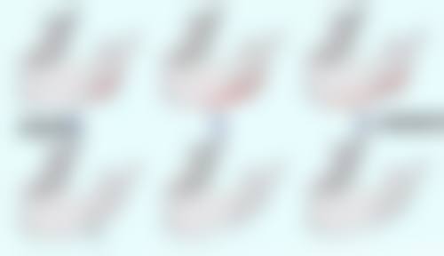 五、腿抽脂有什么危害之美学提示