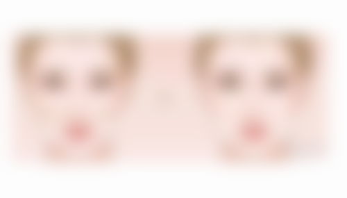 三、如何延长耳软骨隆鼻的术后成效