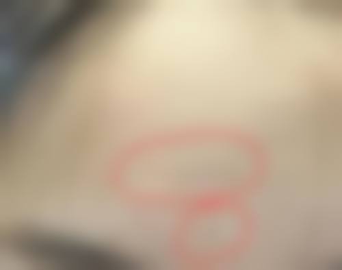 五、绵阳悦她婕熹卡医疗美容诊所价格表