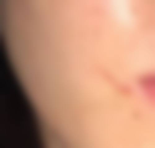 三、绵阳悦她婕熹卡医疗美容诊所诊疗项目有哪些?