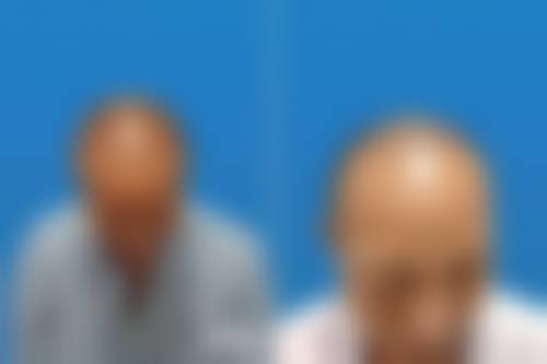 八、广州悦莱美医疗美容诊所真实的患者评价