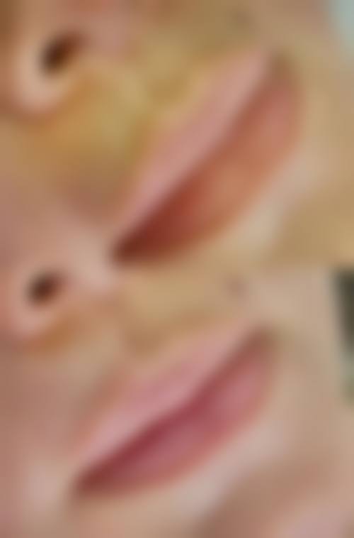 四、广州悦莱美医疗美容诊所特色项目