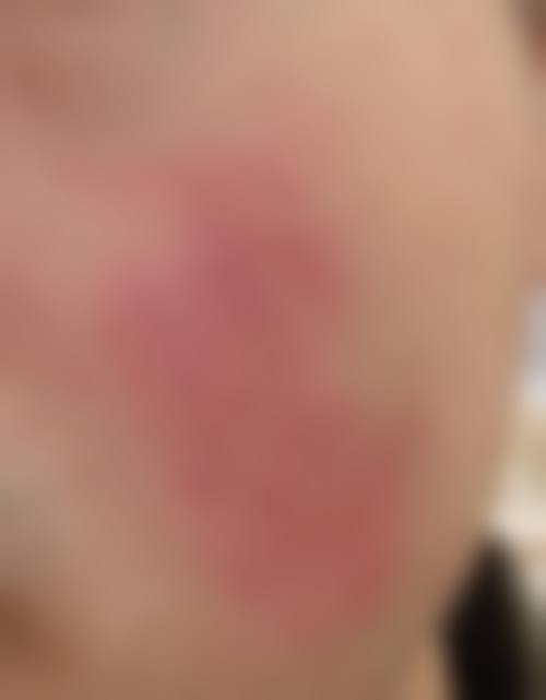 五、德阳东美奥拉克整形医院价格表