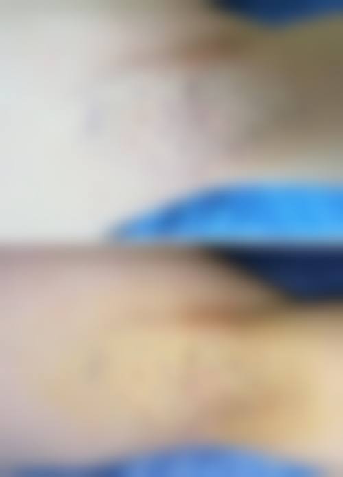 四、广州刘运奇医疗美容诊所特色项目