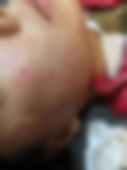 八、扬州邗江区苏忆美容中 心真实的患者评价