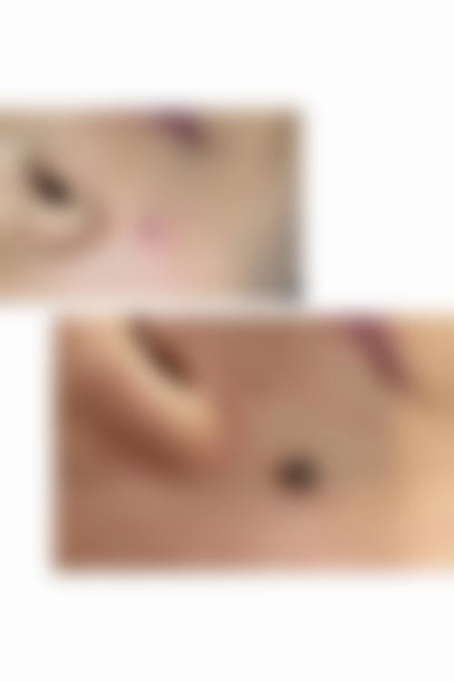 四、重庆第六人民医院整形美容科特色项目