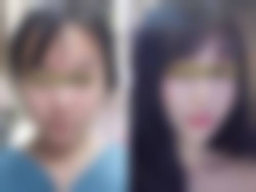 八、武汉慧丽源医疗美容门诊部真实的患者评价