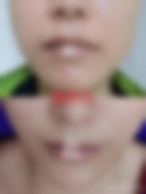 二、丹东纹婷整形医院怎么样?