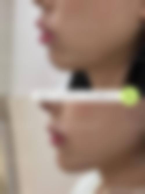 四、韩国未来医疗美容医院特色项目