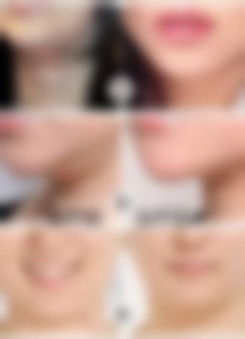 五、泰安市岱岳区皮肤病防治所价格表