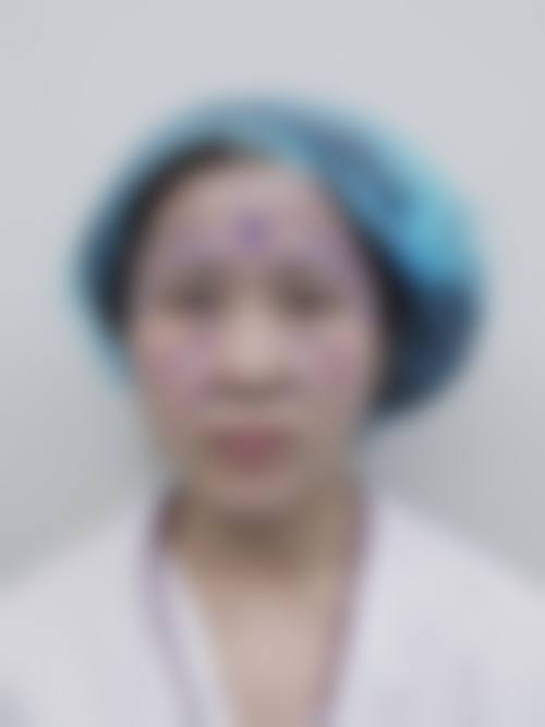 三、丹东纹婷整形医院诊疗项目有哪些?