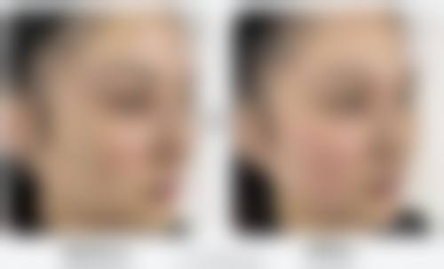 八、广州刘运奇医疗美容诊所真实的患者评价