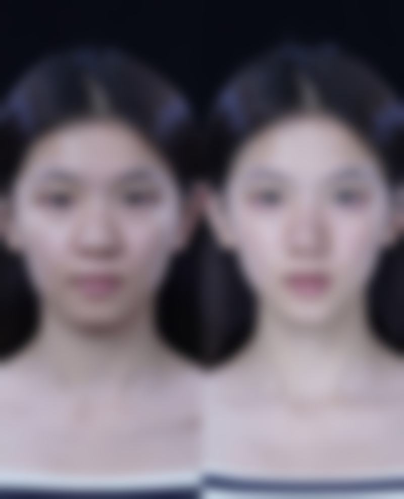 八、西安东方美韵医疗美容诊所真实的患者评价