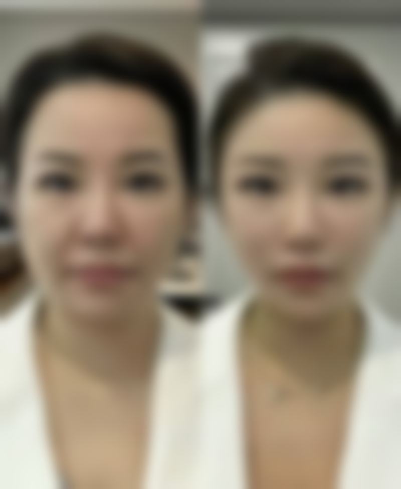 九、兰州时光整形美容医院真实的患者评价