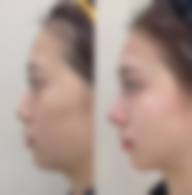 五、蒋有华怎么预约？