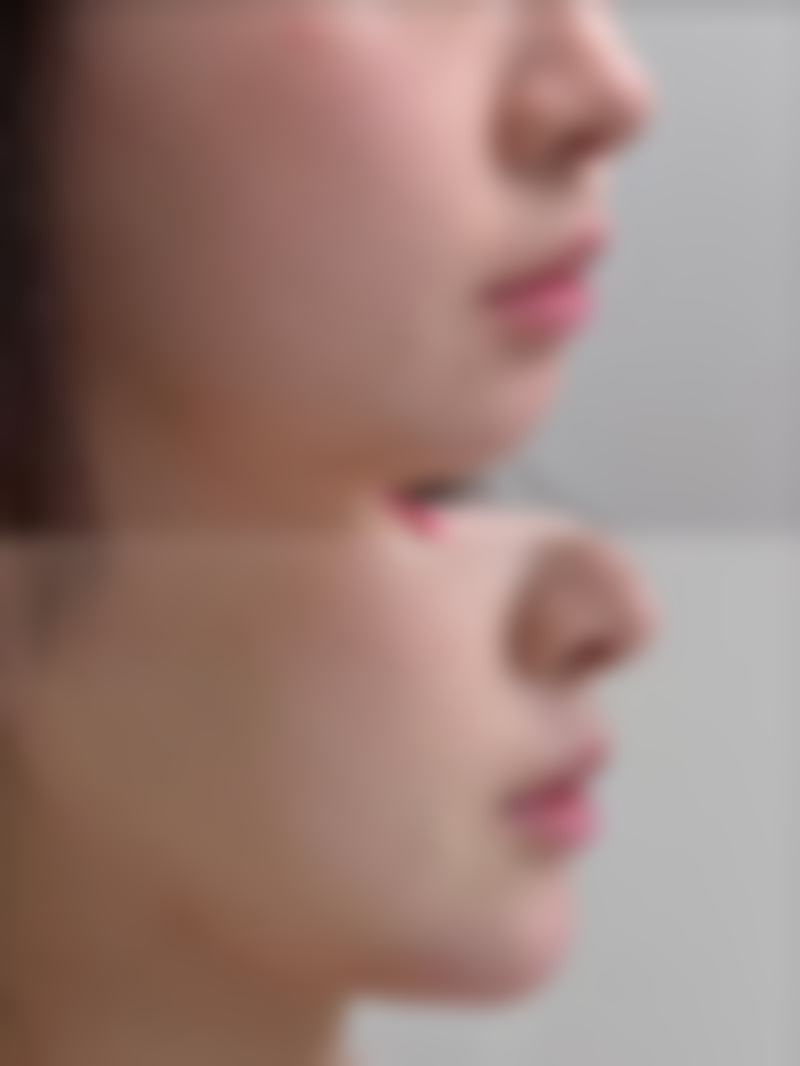 六、兰州时光整形美容医院价格表