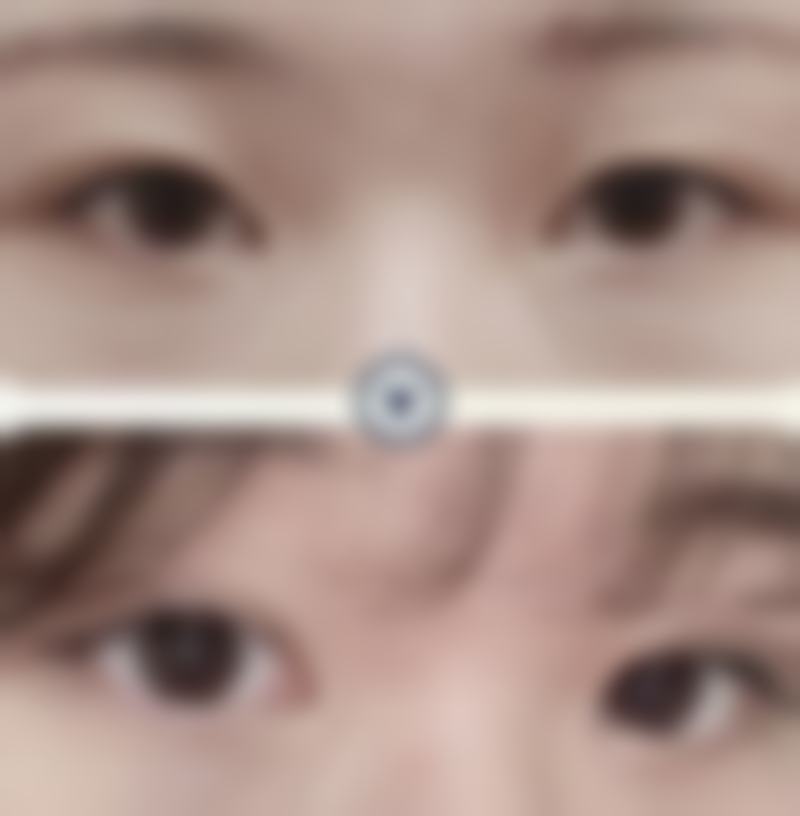 八、赣州肌研觅美整形医院真实的患者评价