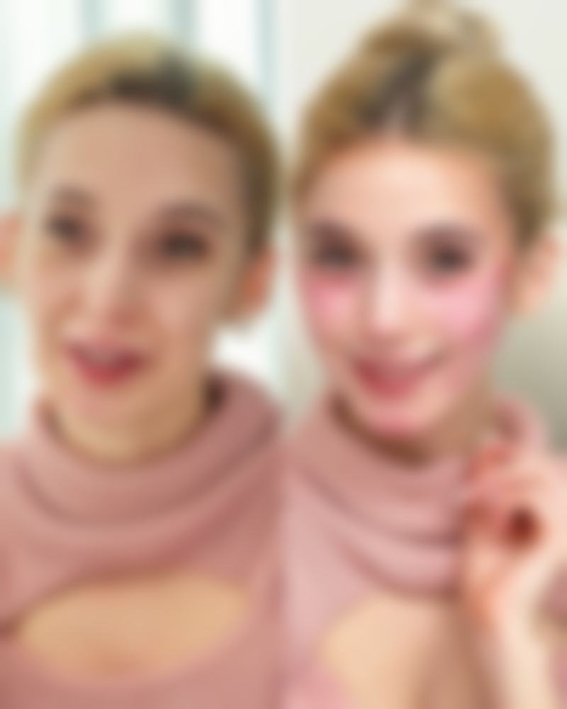 二、种植牙纽白特材质与技术优势