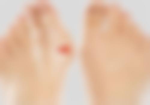 做双眼皮去美容院可以吗？别图便宜踩坑，正规机构安全变美更划算 