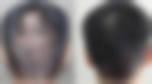 九、重庆伊美密码医疗美容门诊部真实的患者评价