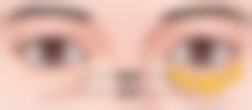 做双眼皮去美容院可以吗？答案显而易见