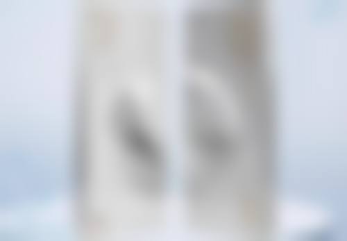 隆鼻能保持一辈子吗？总结与提醒