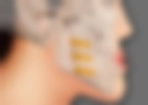 二、不同类型疤痕激光治疗成效分析