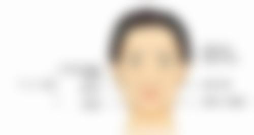 五、激光治疤痕的风险提示与理性认知