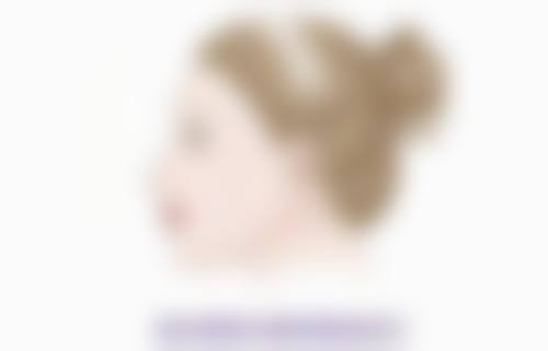 四、其他隆鼻材料及相关情况