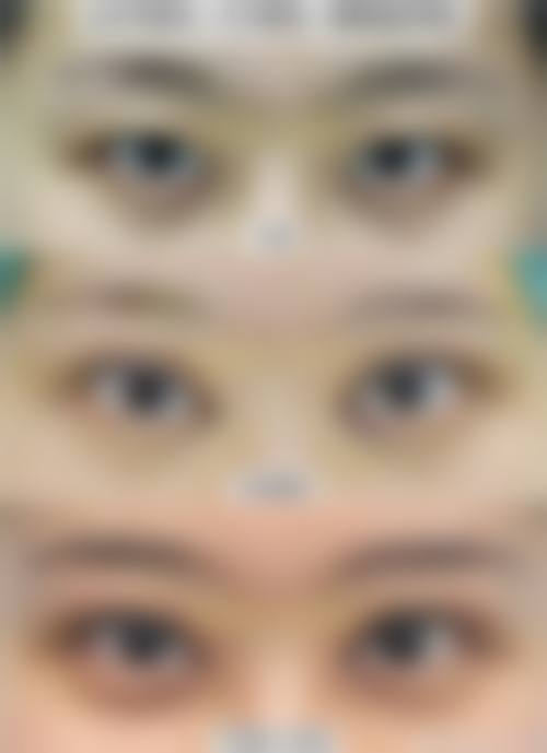 九、赣州梵玛西医疗美容诊所真实的患者评价