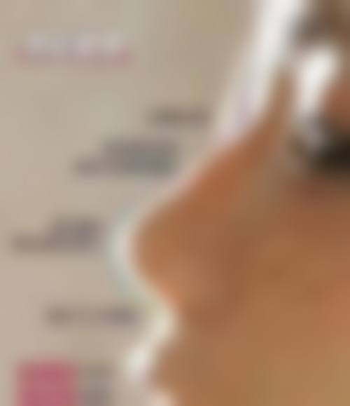 八、韩国江南 stardom 整形外科预约方式