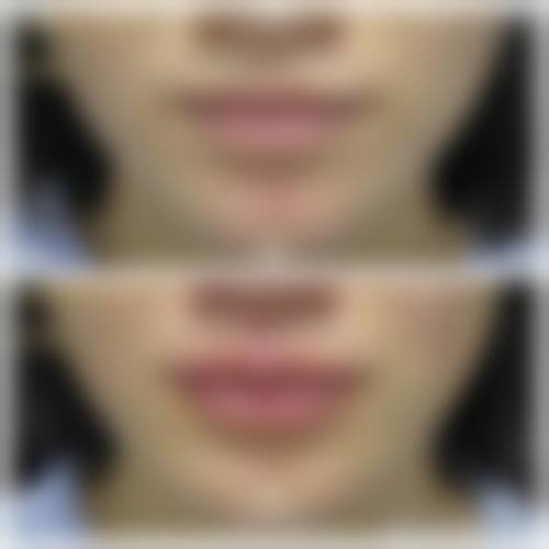 五、韩国江南 stardom 整形外科医生介绍