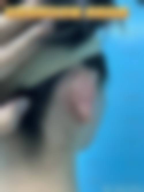 四、哈尔滨即美整形美容医院特色项目