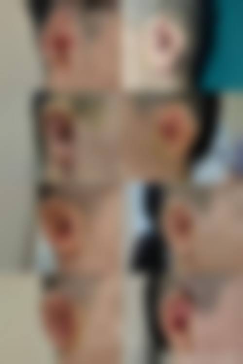 四、丽江靓佳整形医院特色项目