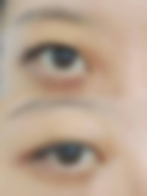 八、苏州维秘医疗美容诊所植发科真实的患者评价