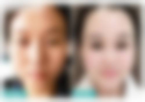 五、台州博雅美惠整形美容医院价格表