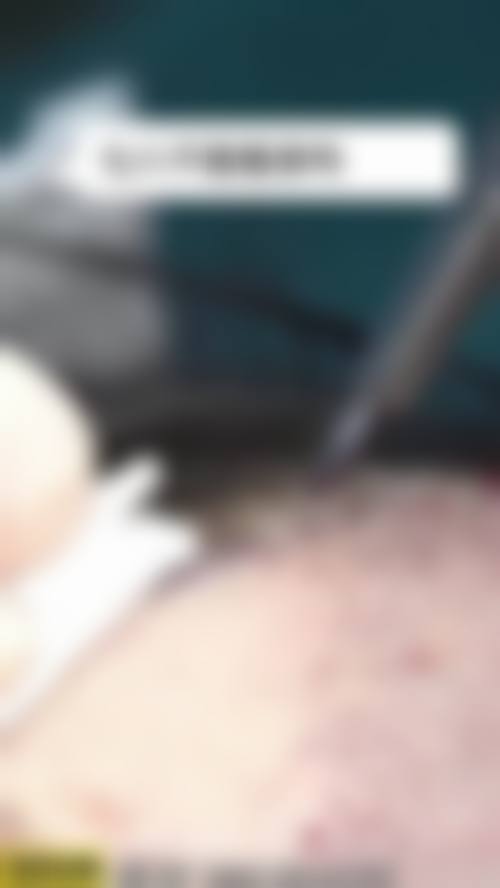 七、苏州维秘医疗美容诊所植发科预约方式