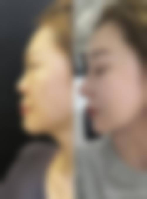 四、重庆伊美密码医疗美容门诊部特色项目