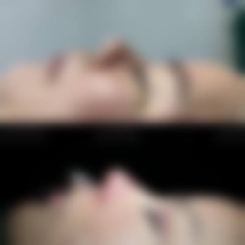 四、郑州安格润医疗美容门诊部特色项目