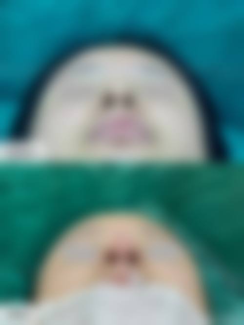 六、郑州安格润医疗美容门诊部价格表