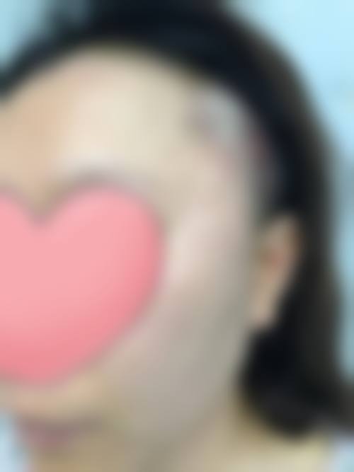 三、泉州市万喜医疗美容诊疗项目有哪些？