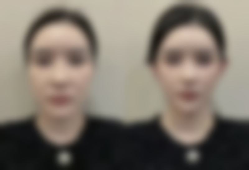 四、北京亚汇利医疗美容诊所特色项目