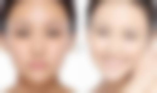 三、加速腹部吸脂后消肿的方法